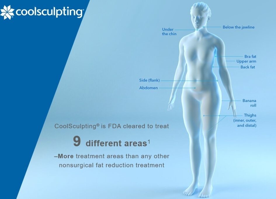 Coolsculpting